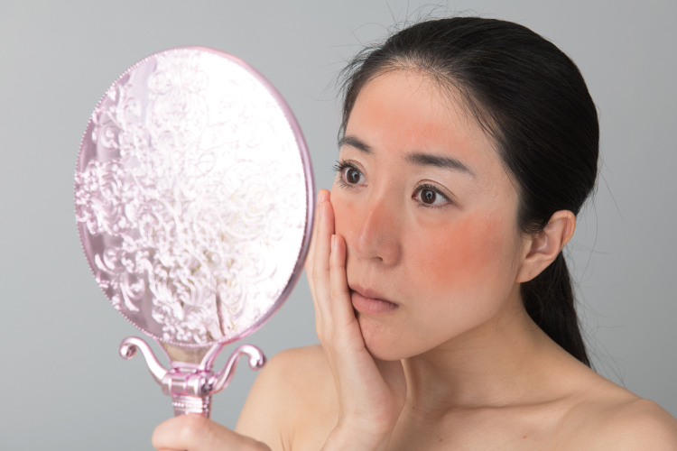 肌に炎症が起こっている女性