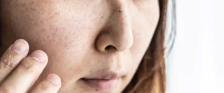 肌がくすんでいる女性